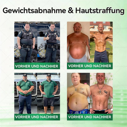 𝗢ffizieller Shop | 🇩🇪𝖲𝗎𝗋𝗀𝗈ᴎ𝗂𝗑® 𝗠𝗼𝗿𝗶𝗻𝗴a · 𝗕erberin ＆ NAD＋10-IN-1 𝗙ortschrittliches 𝗡ano-Mikronadel-𝑷𝒇𝒍𝒂𝒔𝒕𝒆𝒓 (1x täglich, sichtbare Veränderungen in 7 Tagen) 🥗 Für Adipositas, Herz-Kreislauf-Gesundheit, Diabetes, Schlafapnoe, Gelenkprobleme u.v.m